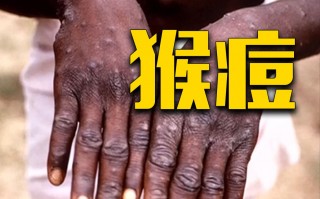 莫桑比克报告首例猴痘病例的简单介绍