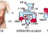 溃疡性结肠炎和克罗恩病的区别(溃疡性结肠炎和克罗恩病的区别方法)