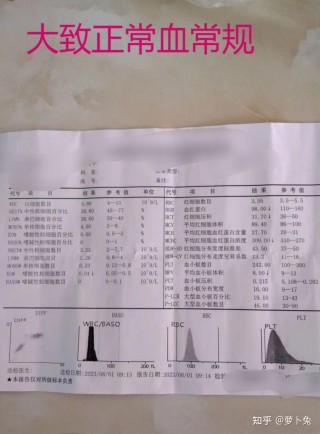 血小板增多症能治好吗(血小板增多怎么治疗,能治愈吗)